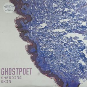 Shedding Skin